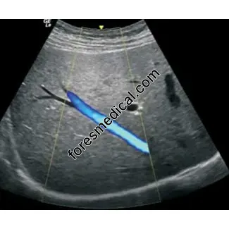 GE - GE C1-5-D C1-5-RS Ultrasund Probe Head Scanner Crystal 